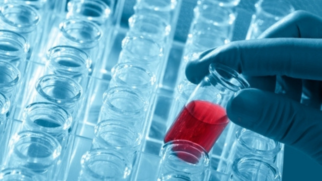 Metallothionein and Autism Update