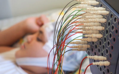 Seizures Main Info Page