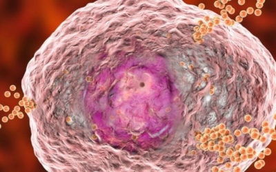 Mast Cell Activation Syndrome Main Info Page