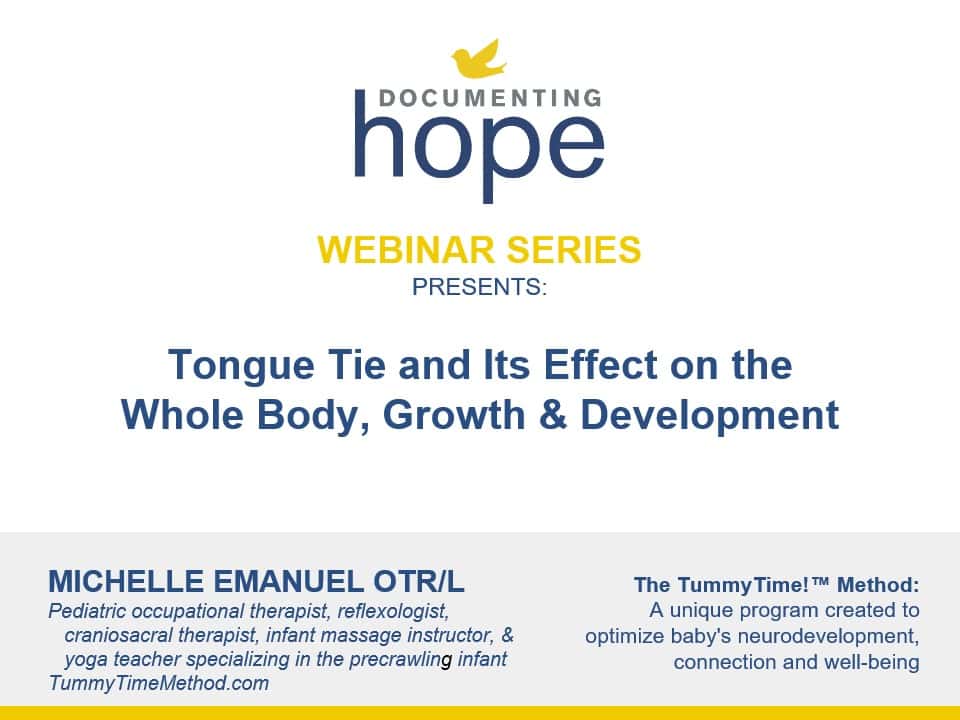 Tongue Tie and Its Effect on the Whole Body, Growth and Development with Michelle Emanuel