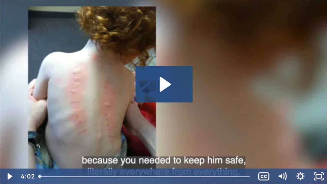 Eli Overcame Asthma and Eczema and Significantly Improved His Food Allergies